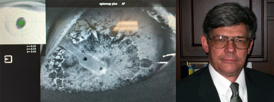 Photo of Ross A. Doerr next to an x-ray photograph of the ARGUS II Artificial Retinal Implant tacked onto his retina.